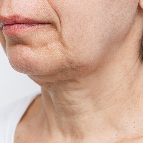 locação de equipamentos de clinica de estetica Bacacheri, Curitiba locação de equipamentos de clinica de estetica Bacacheri, Curitiba