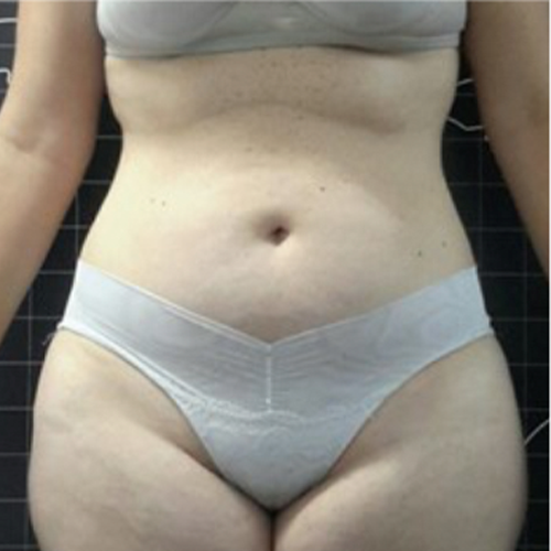 Alugue o aparelho BHS 156