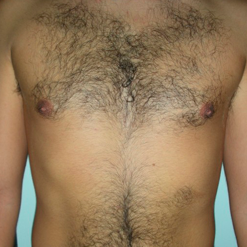 MEDIOSTAR NEXT PRO MEDIOSTAR NEXT PRO